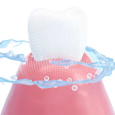 Teeth Whitening in Pflugerville and Round Rock
